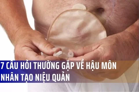 7 câu hỏi thường gặp về hậu môn nhân tạo niệu quản