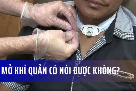 Mở khí quản có nói được không?