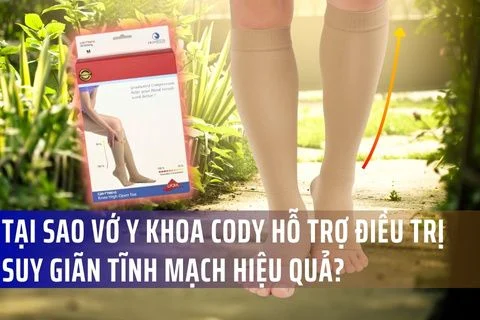 Tại sao vớ y khoa Cody hỗ trợ điều trị suy giãn tĩnh mạch hiệu quả?