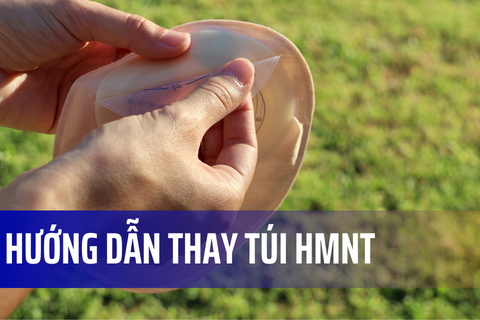 Hướng dẫn thay túi hậu môn nhân tạo