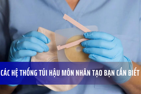 Tìm hiểu về các loại hệ thống túi hậu môn nhân tạo