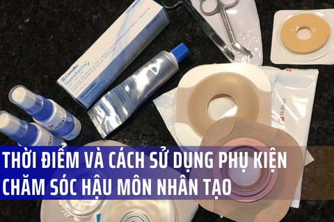 Phụ kiện Hậu môn nhân tạo: Thời điểm và Cách sử dụng