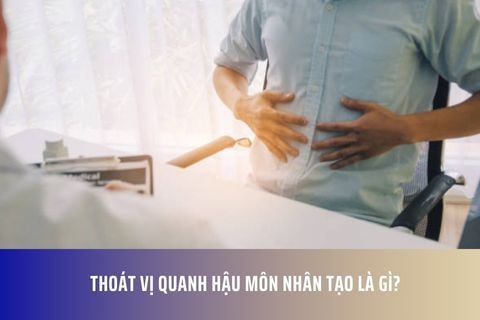Thoát vị quanh hậu môn nhân tạo là gì?