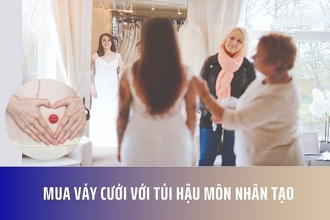 Mua váy cưới với túi hậu môn nhân tạo
