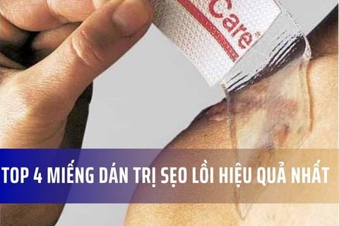 Top 4 miếng dán trị sẹo lồi hiệu quả nhất hiện nay