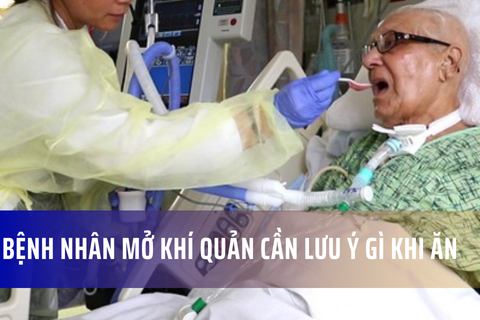 Bệnh nhân mở khí quản cần lưu ý gì khi ăn