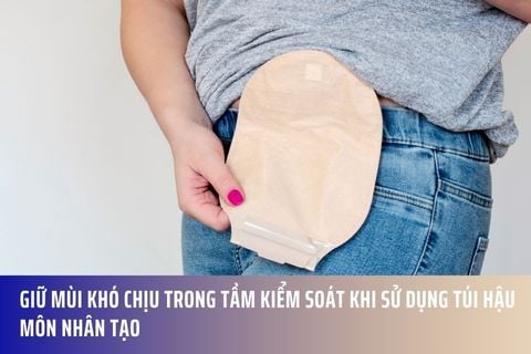 Giữ Mùi Khó Chịu Trong Tầm Kiểm Soát Khi Sử Dụng Túi Hậu Môn Nhân Tạo