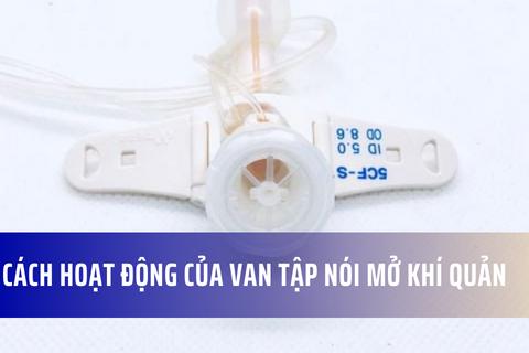 Cách thức hoạt động của van tập nói cho bệnh nhân mở khí quản