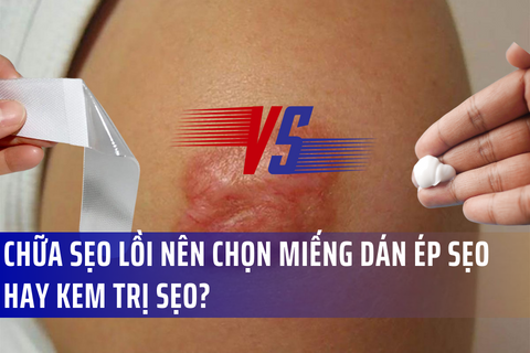 Miếng dán sẹo silicone vs. Gel sẹo silicone: Loại nào tốt hơn cho sẹo lồi?