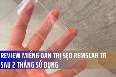 Review miếng dán trị sẹo RemScar TR sau 2 tháng sử dụng