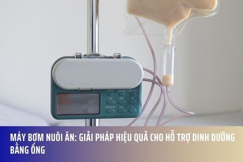 Máy Bơm Nuôi Ăn: Giải Pháp Hiệu Quả Cho Hỗ Trợ Dinh Dưỡng Bằng Ống