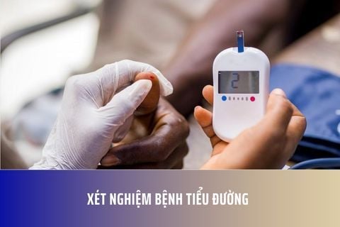 Xét nghiệm bệnh tiểu đường