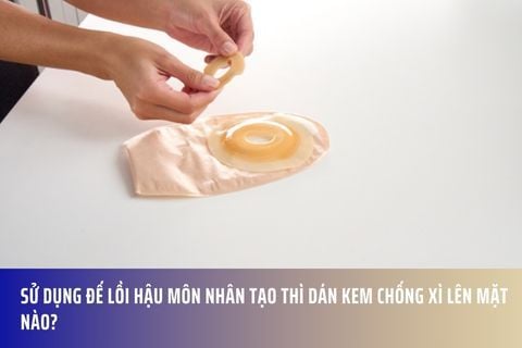 Sử dụng đế lồi hậu môn nhân tạo thì dán kem chống xì lên mặt nào?
