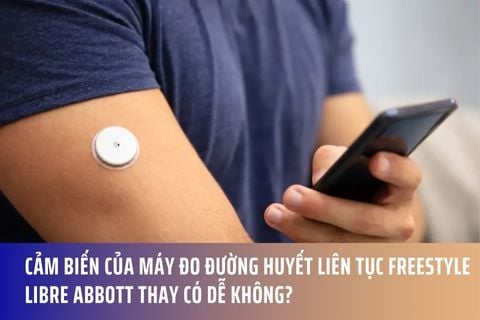 Cảm biến của máy đo đường huyết liên tục Freestyle Libre Abbott thay có dễ không?