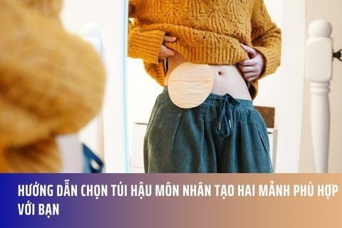 Hướng Dẫn Chọn Túi Hậu Môn Nhân Tạo Hai Mảnh Phù Hợp Với Bạn