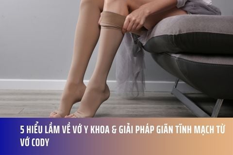5 Hiểu Lầm Về Vớ Y Khoa & Giải Pháp Giãn Tĩnh Mạch Từ Vớ Cody
