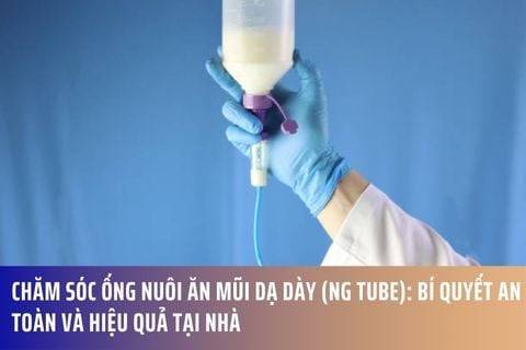 Chăm Sóc Ống Nuôi Ăn Mũi Dạ Dày (NG Tube): Bí Quyết An Toàn Và Hiệu Quả Tại Nhà