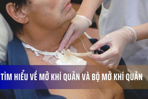 Tìm hiểu về mở khí quản và bộ mở khí quản